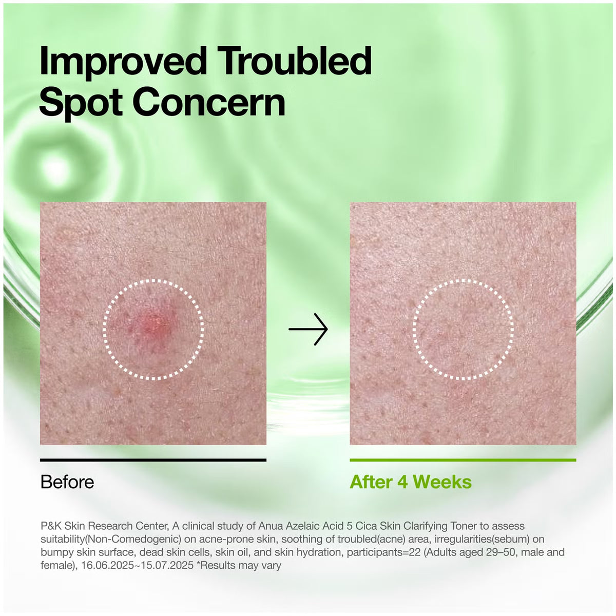 Anua Azelaic Acid 3+ Cica Clarifying Toner